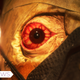 A bloodshot eyeball stares.